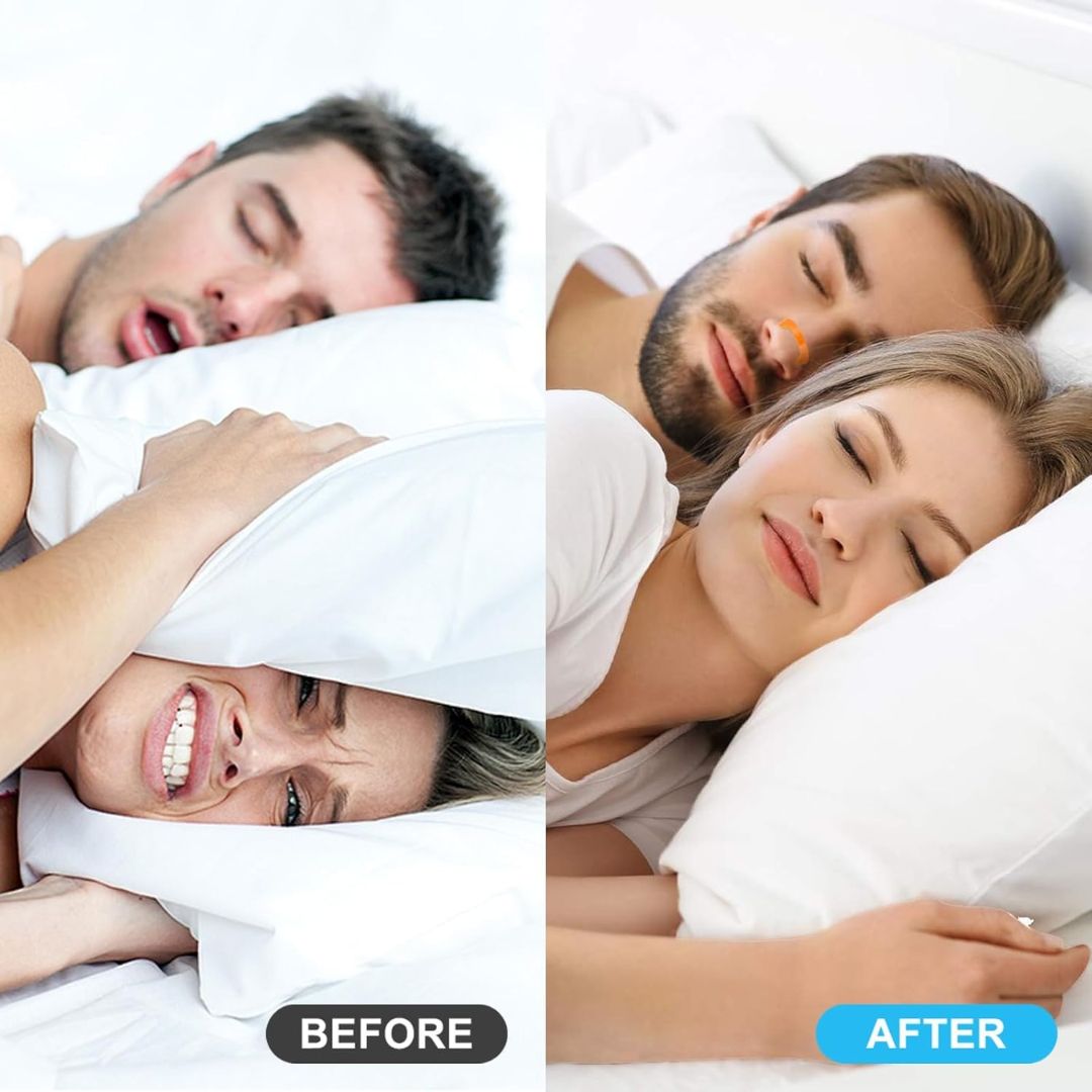 Magnetic Breathing Nasal Strip (Buy 1 Get 1 Free)